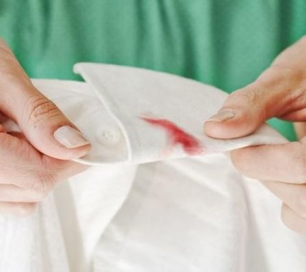 7 trucos para manchas de sangre ropa › Ahorradoras.com